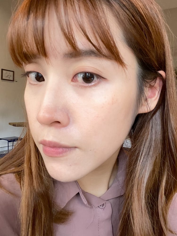 DermaAngel-1