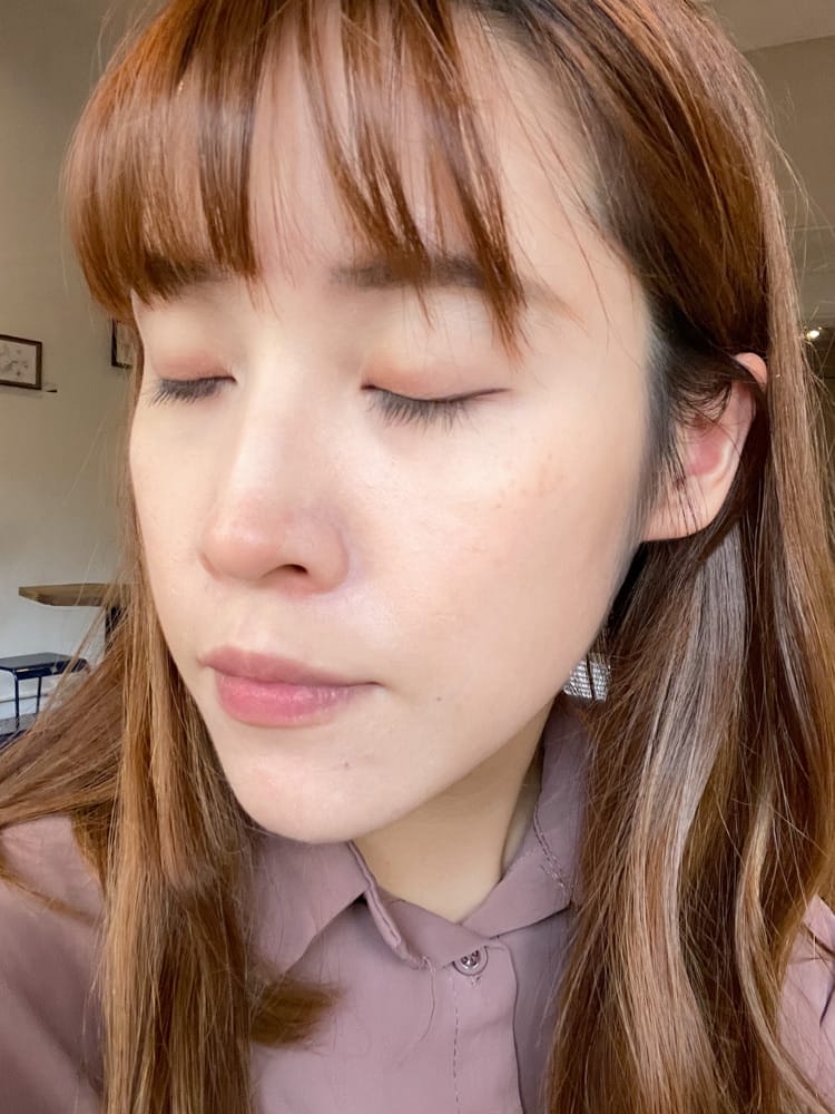 DermaAngel-2