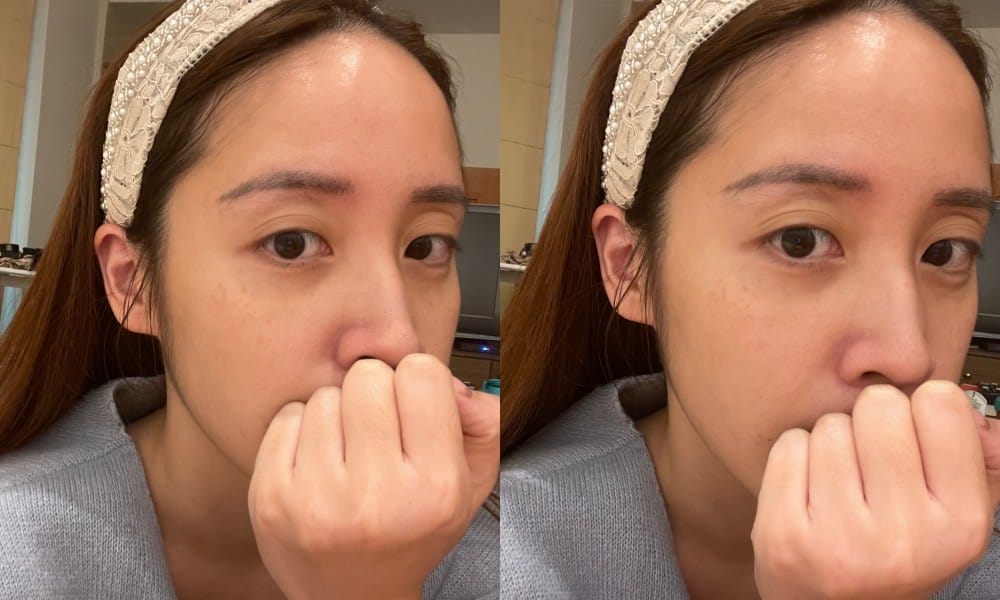 肌膚近拍