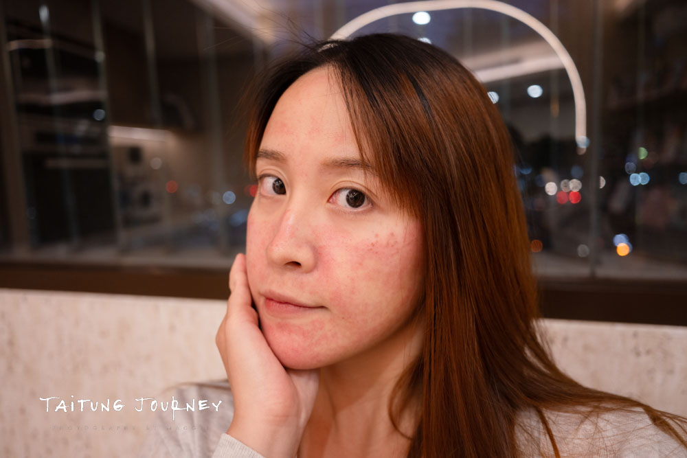 台北皮秒蜂巢雷射推薦｜幸衍醫美診所 專業團隊 量身訂製無瑕美肌