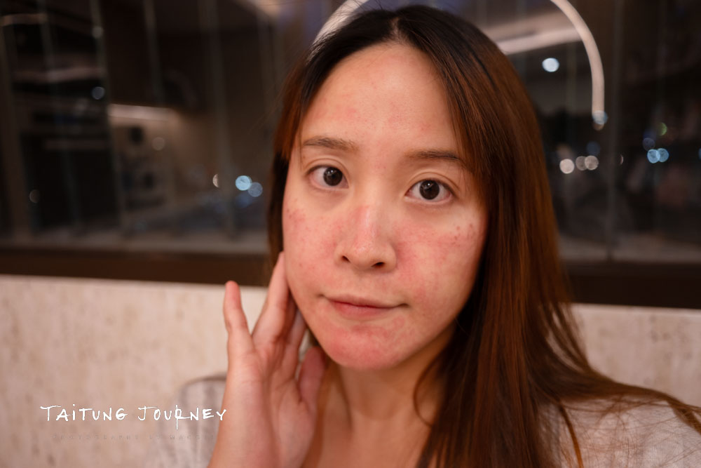 台北皮秒蜂巢雷射推薦｜幸衍醫美診所 專業團隊 量身訂製無瑕美肌