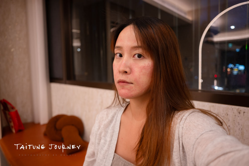 台北皮秒蜂巢雷射推薦｜幸衍醫美診所 專業團隊 量身訂製無瑕美肌