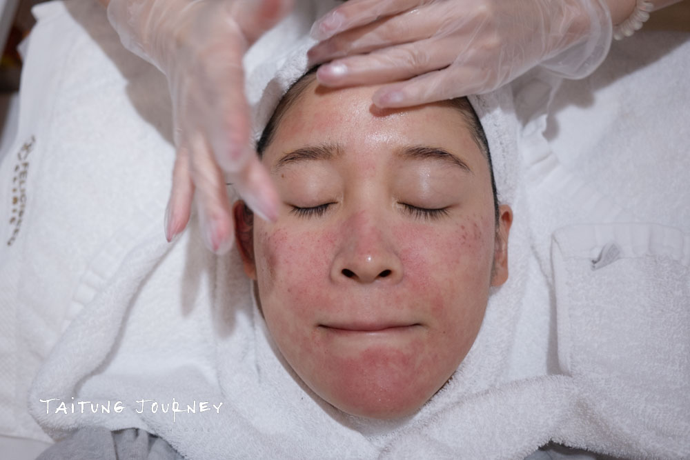 台北皮秒蜂巢雷射推薦｜幸衍醫美診所 專業團隊 量身訂製無瑕美肌