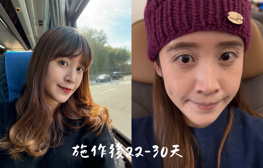 台北皮秒蜂巢雷射推薦｜幸衍醫美診所 專業團隊 量身訂製無瑕美肌