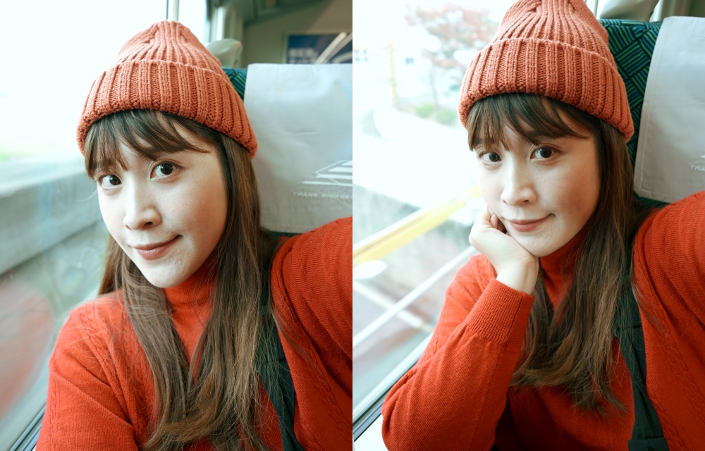 台北皮秒蜂巢雷射推薦｜幸衍醫美診所 專業團隊 量身訂製無瑕美肌